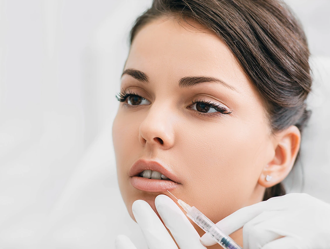 Dermal Filler Teatment By Dr Meenal Patel